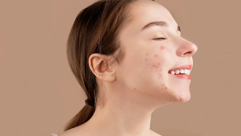 Thay đổi mỹ phẩm nếu tính trạng da không được cải thiện Thay đổi mỹ phẩm nếu tính trạng da không được cải thiện