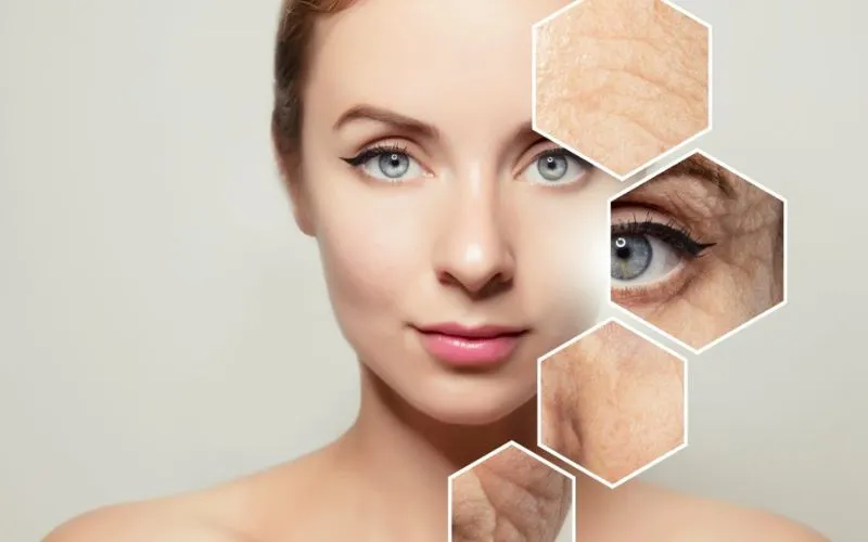 Da chảy xệ và nhiều nếp nhăn